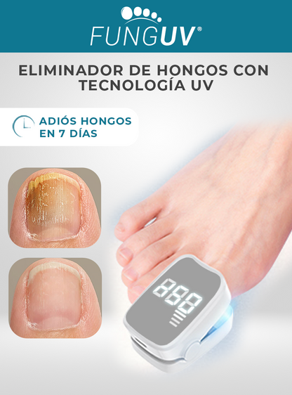 FUNGUV®